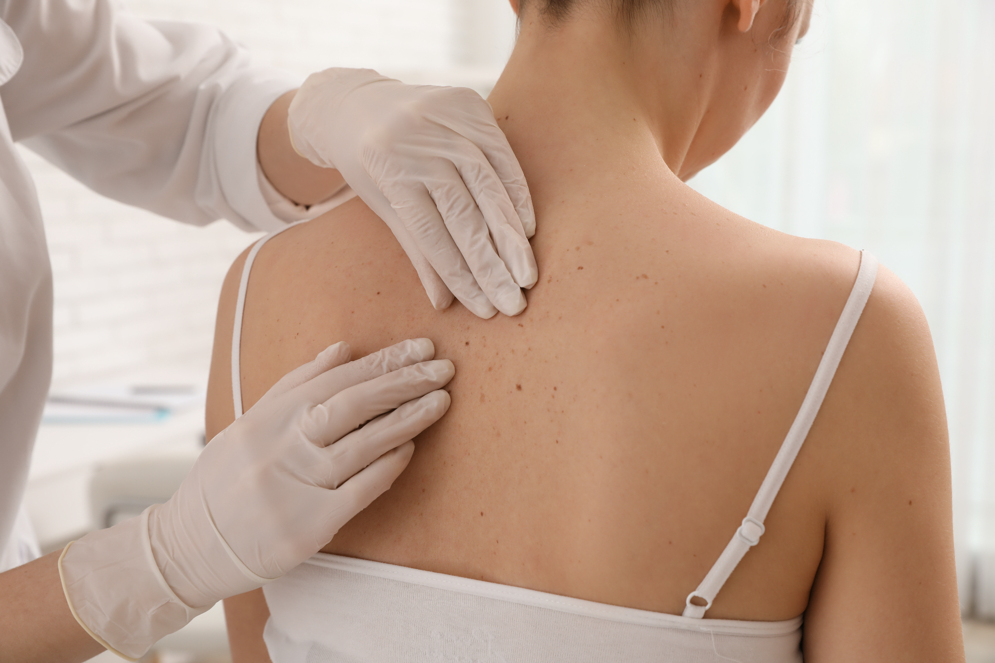 Res je dobro poznati osebo, ki ji je dermatologija blizu